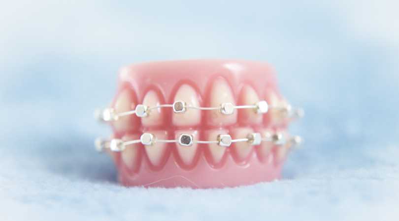 fil orthodontique