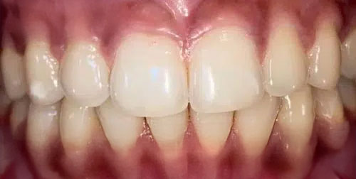 Cas-cliniques-apres-Dentiste-Fontenay