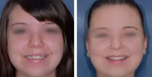 Cas-cliniques-avant-et-apres-Dentiste-94