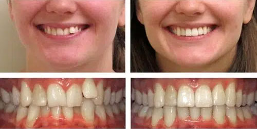 Cas-cliniques-avant-et-apres-Dentiste